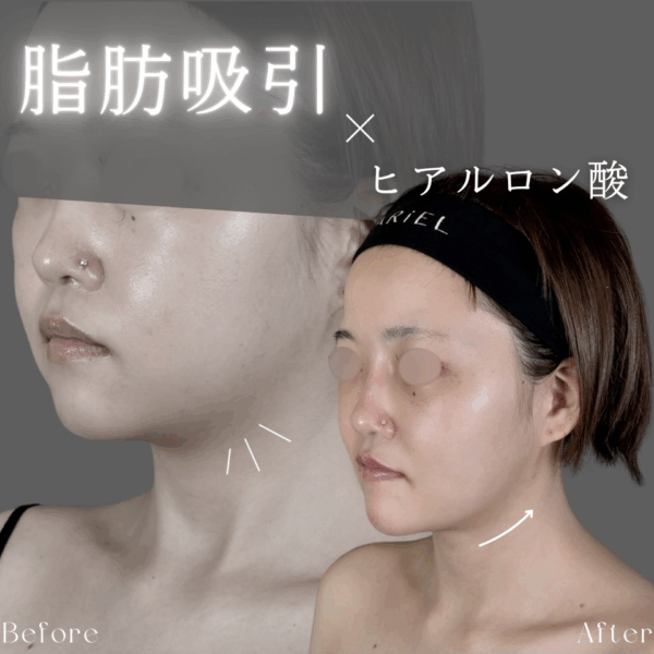 No.8682の症例写真